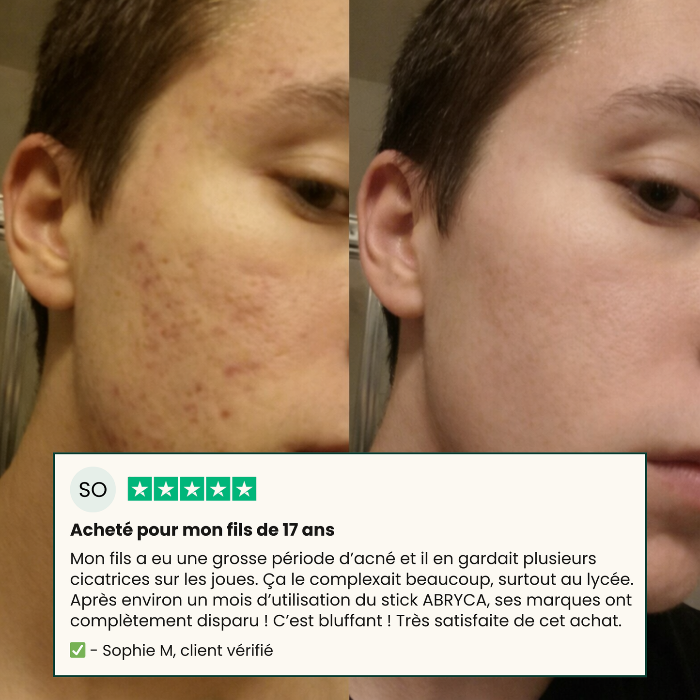 Stick Réparateur N°01 – Silicone Médical Haute Précision